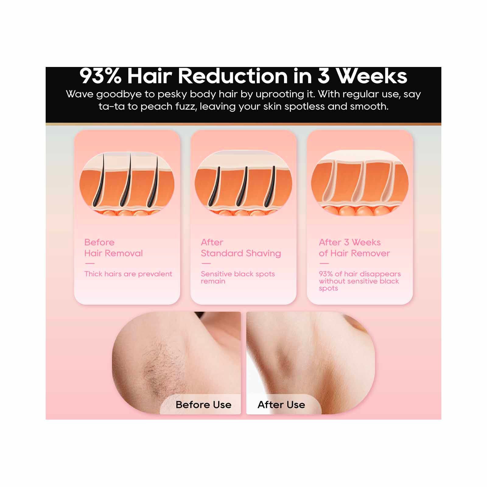 DREAME Ipl Hair Removal - Pink DM-IPLHAIR-PK-image 4